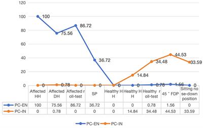 Retrospective analysis of nystagmus characteristics and clinical applications of positional testing in patients with cupulolithiasis of the posterior semicircular canal in benign paroxysmal positional vertigo